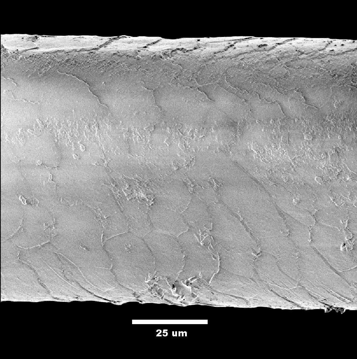 Alpaca fibre under a scanning electron microscope — external visual reference