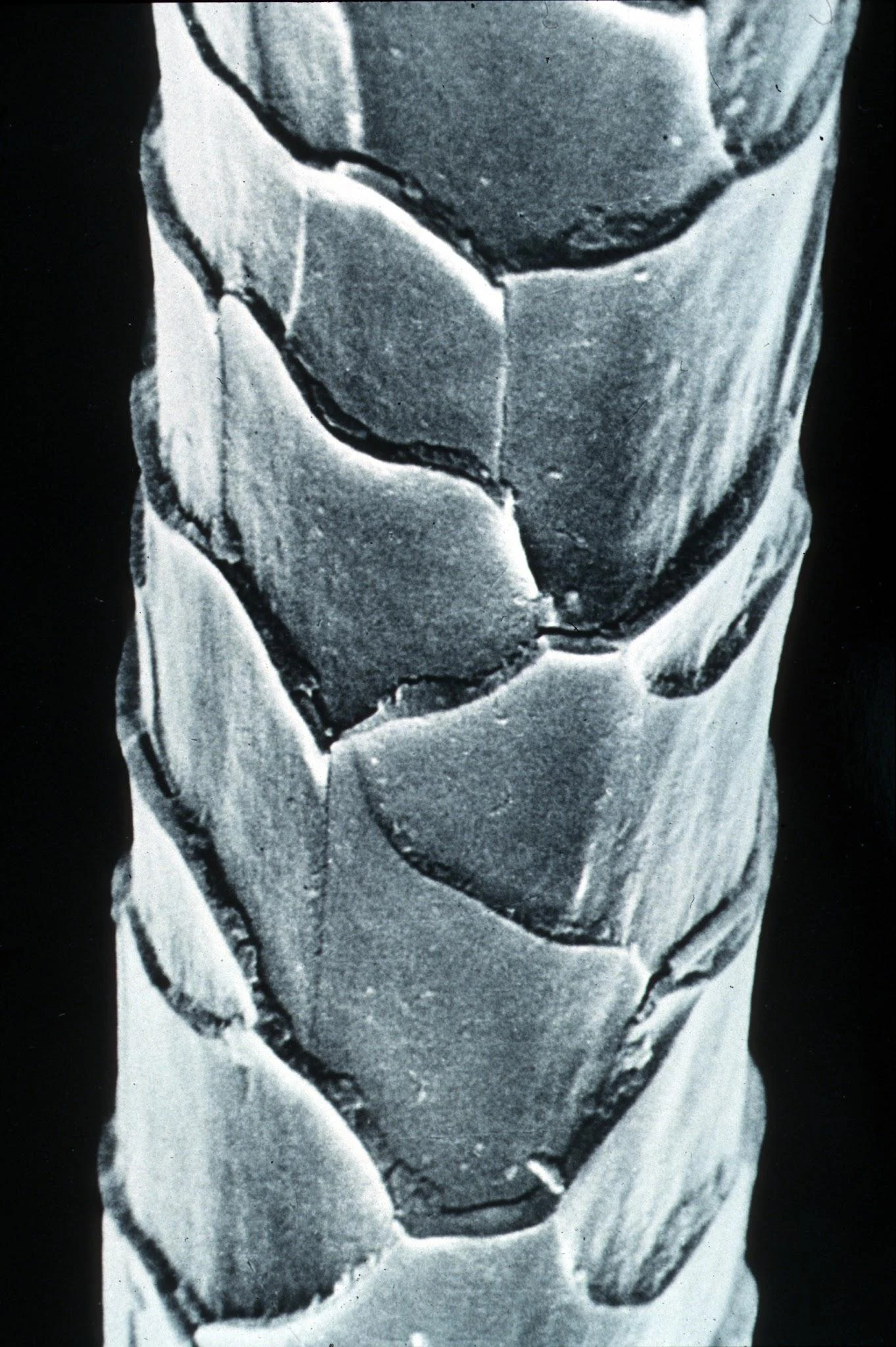 Merino wool micrograph — external visual reference